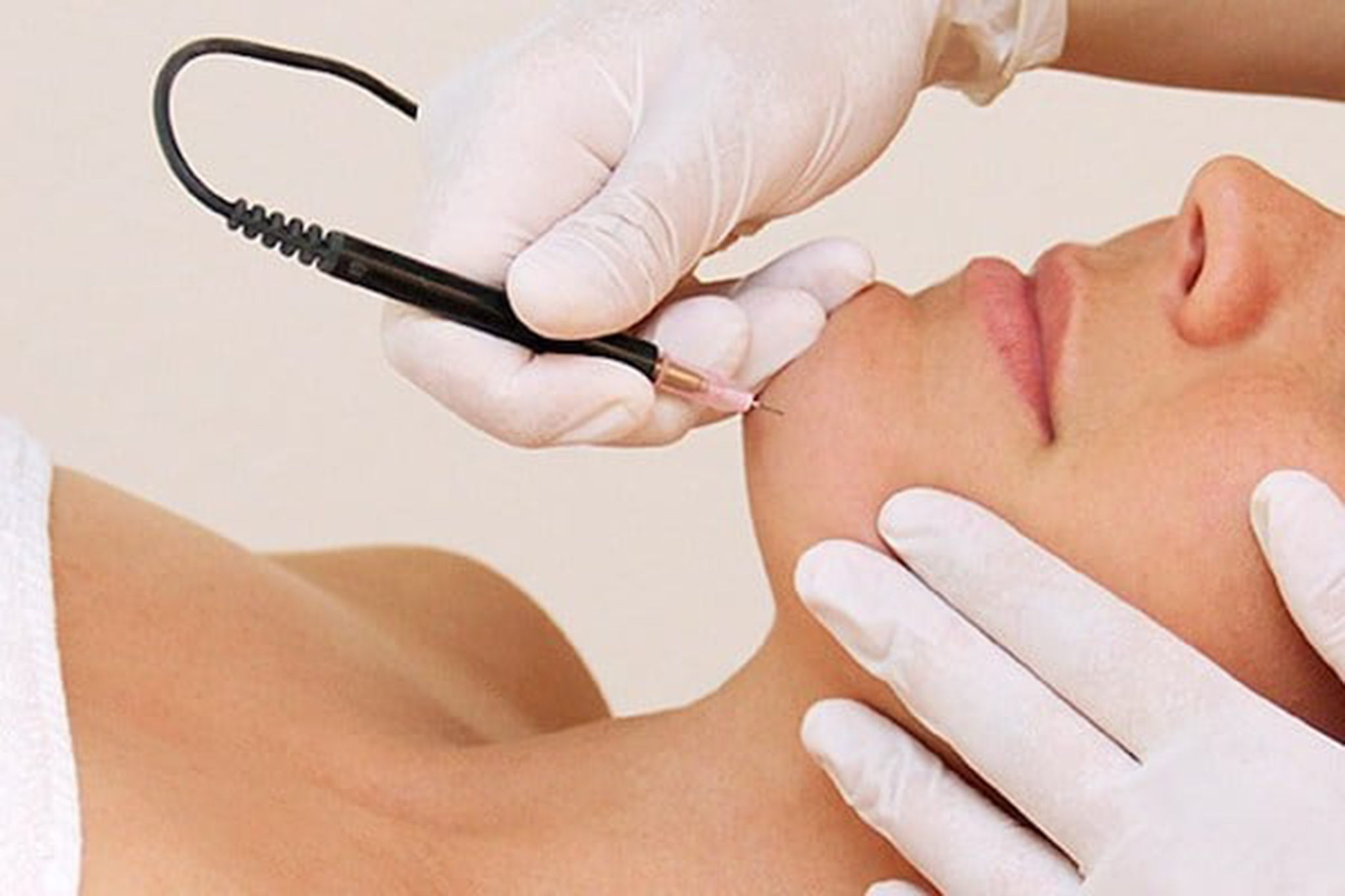 Le Plaisir electrolysis skin treatment service in Kaiapoi, New Zealand